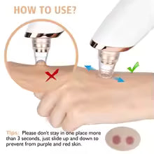 Blackhead Remover Pore Vacuum with Camera – Upgraded Face Pore Cleanser WiFi Real-Time Visual with 3 Adjustable Suction & 5 Probes