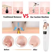 Blackhead Remover Pore Vacuum with Camera – Upgraded Face Pore Cleanser WiFi Real-Time Visual with 3 Adjustable Suction & 5 Probes